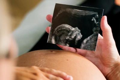 Poród naturalny, znieczulenie - zasady w 2026 roku