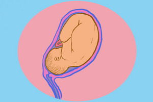 Przebieg ciąży: tydzień 32 - 35