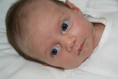 Trądzik niemowlęcy – skąd się bierze i jak go leczyć?