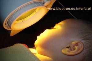  Światłoterapia Bioptron w pediatrii