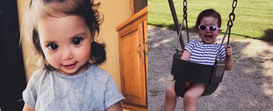 Duże oczy dziewczynki to efekt choroby - Wygląda pięknie czy dziwnie? 