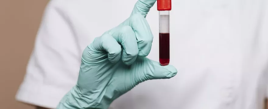 Morfologia krwi – co wskazuje i jak interpretować wyniki?